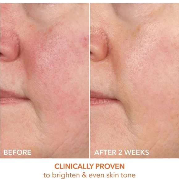 Gift 💝 Dr Dennis Gross Vitamin C Lactic 15% Firm & Bright treatment - Picture 8 of 8